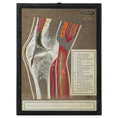 Antique Scientific Demonstration Model, Bone Cut of the Human Knee Joint