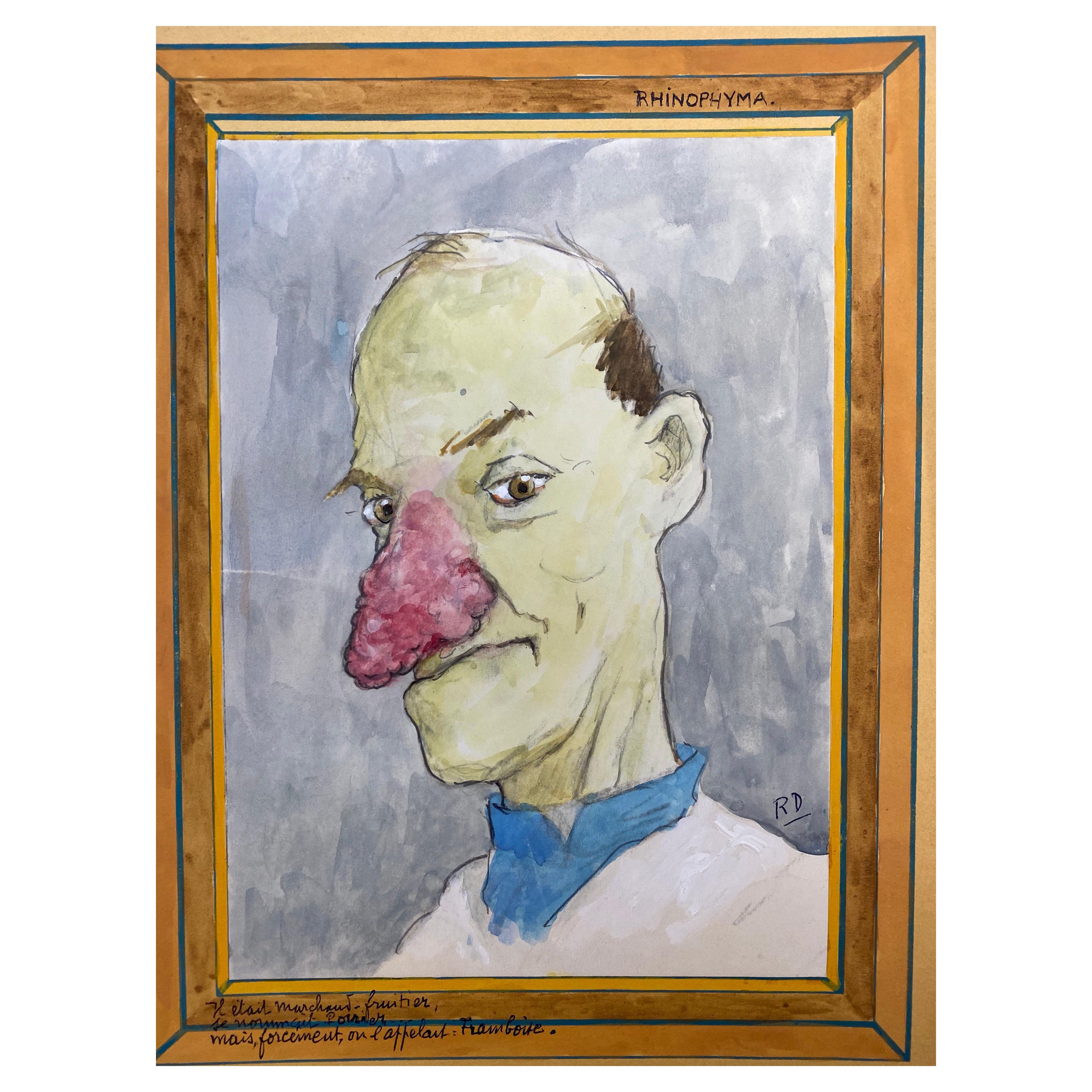 1960's French Portrait Man Very Red Nose Caricature For Sale