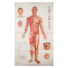 Vintage Chinese Acupuncture Posters, c.1976
