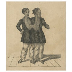Antique Print of Conjoined or Siamese Twins, c.1860