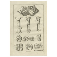 Impression antique d'anatomie des organes reproductifs féminins, 1798
