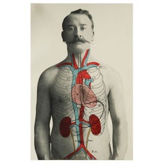 Original Vintage Medical Print- Kidneys, C.1900
