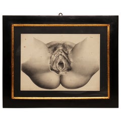 Lithographic Print on Paper, Depicting the Female Genital System, France 1850 Ca