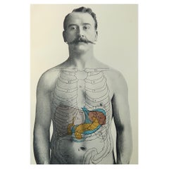 Original Vintage Medical Print- Liver, Spleen and Pancreas, C.1900