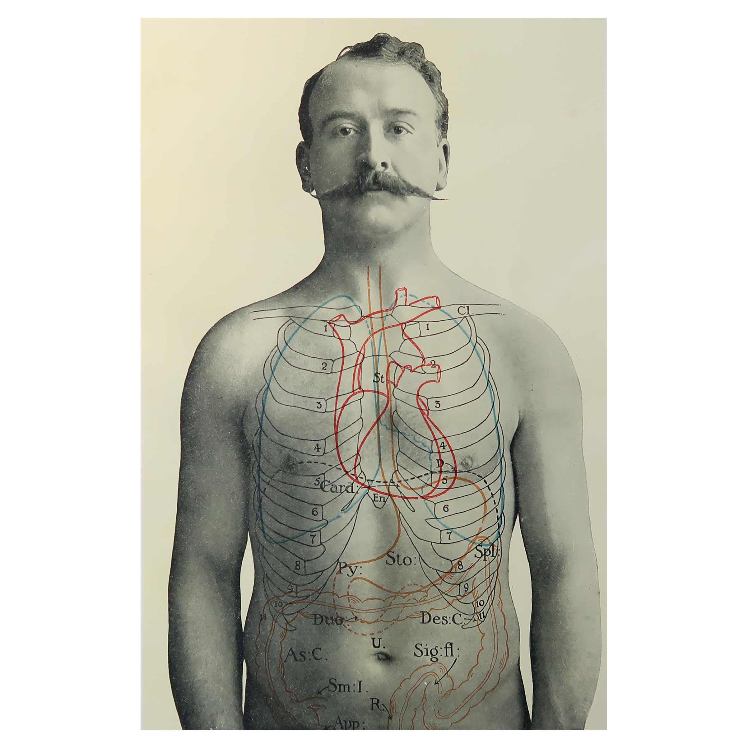 Original Vintage Medical Print- Stomach, C.1900