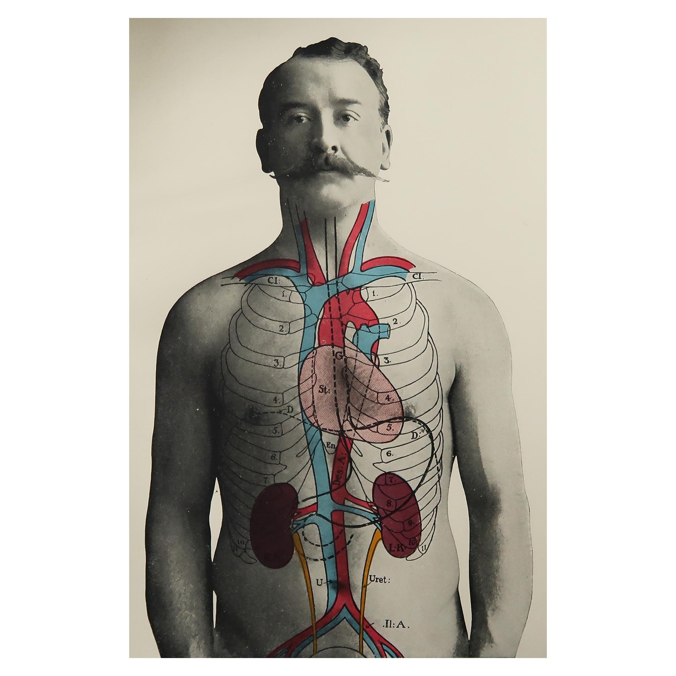 gabapentin kidneys dogs