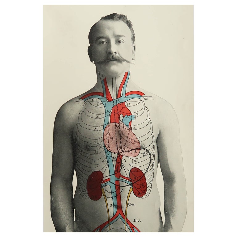 Original Vintage Medical Print, Kidneys, C.1900 at 1stDibs