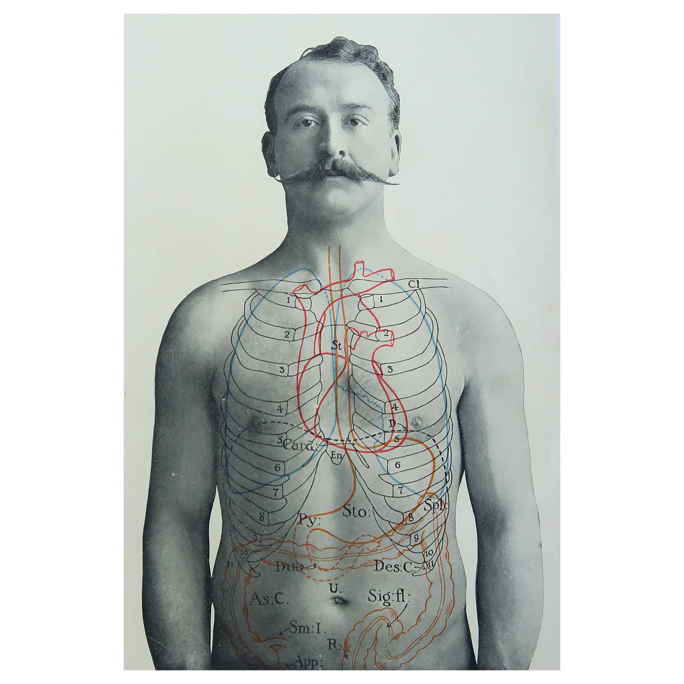 Antique Medical Print 'Pl. IX' by D. Diderot, circa 1760 For Sale at