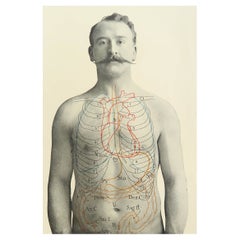 Original Vintage Medical Print, Stomach, circa 1900