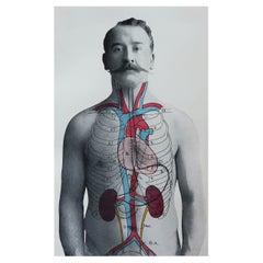 Original Vintage Medical Print, Kidneys, C.1900