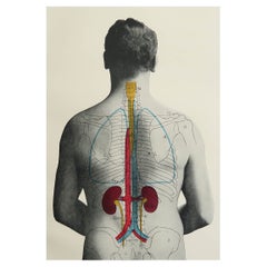 Original Vintage Medical Print- Kidneys, C.1900