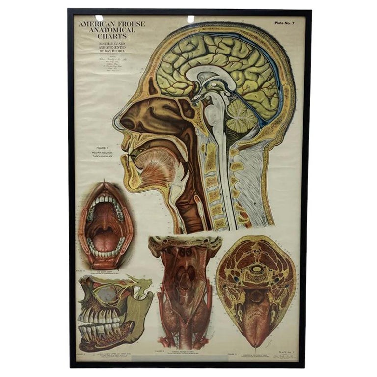 American Frohse Anatomical Chart  For Sale