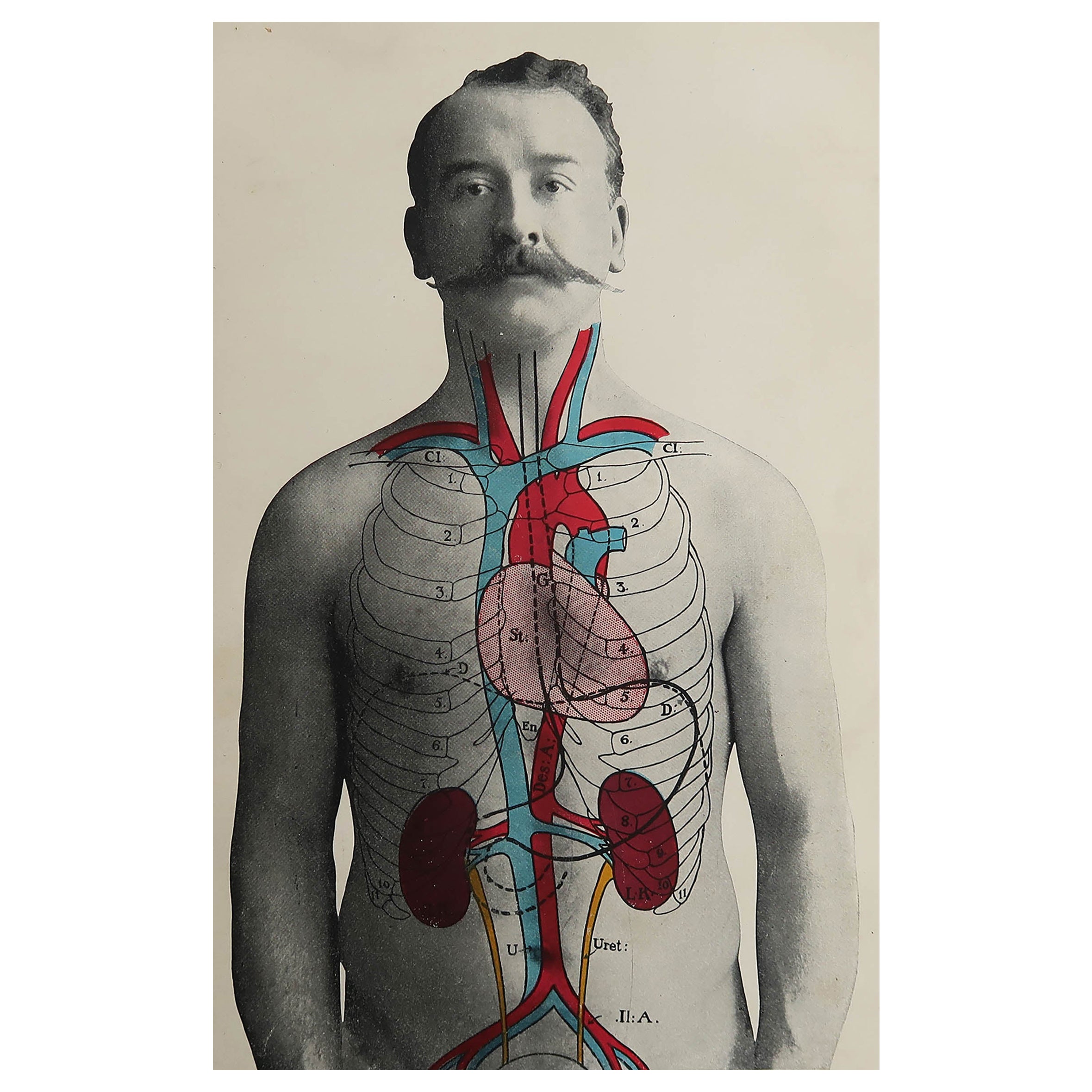 Set of 8 Original Vintage Medical Prints at 1stDibs tree surgeon turvey