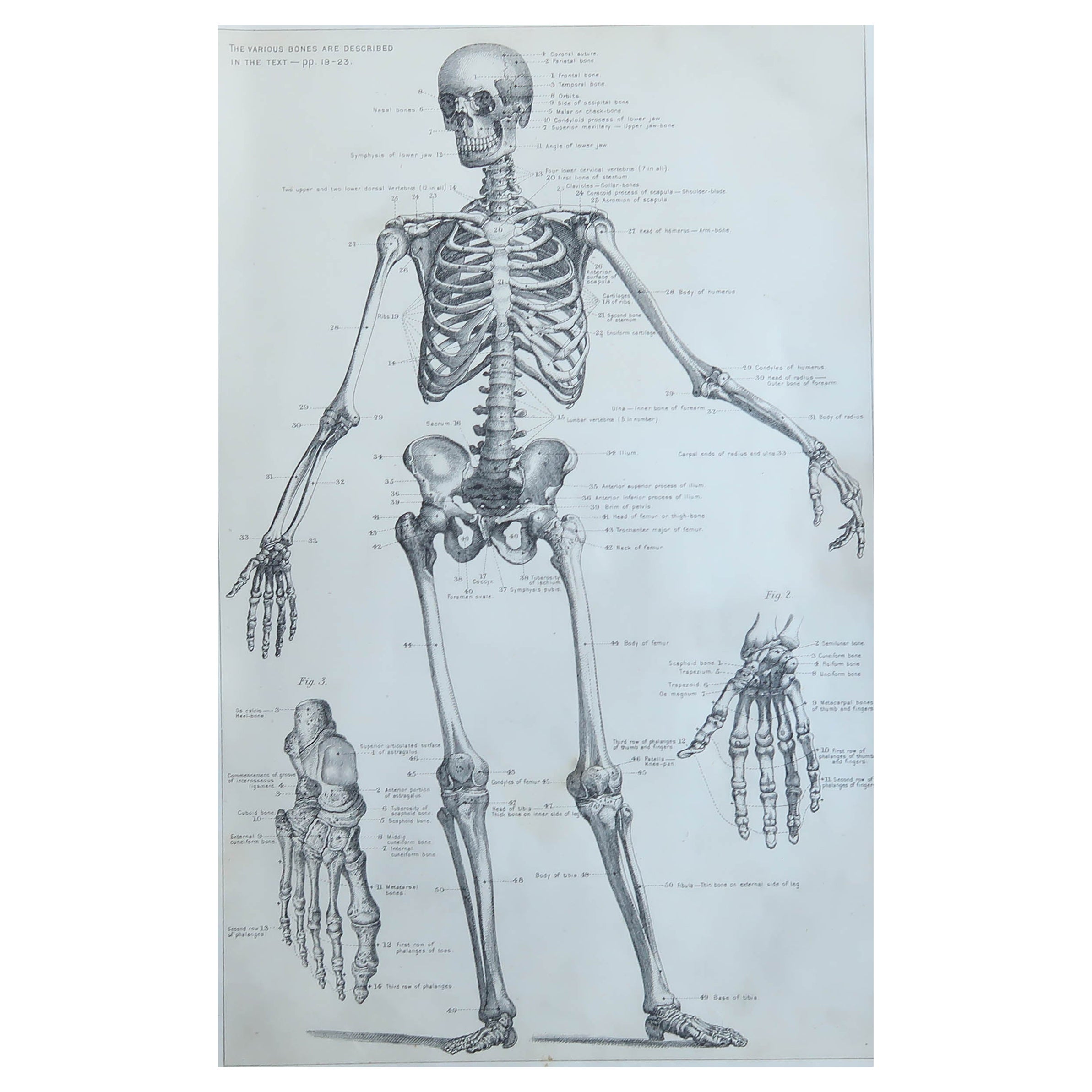 Original Vintage Medical Print-Skeleton, circa 1900 For Sale