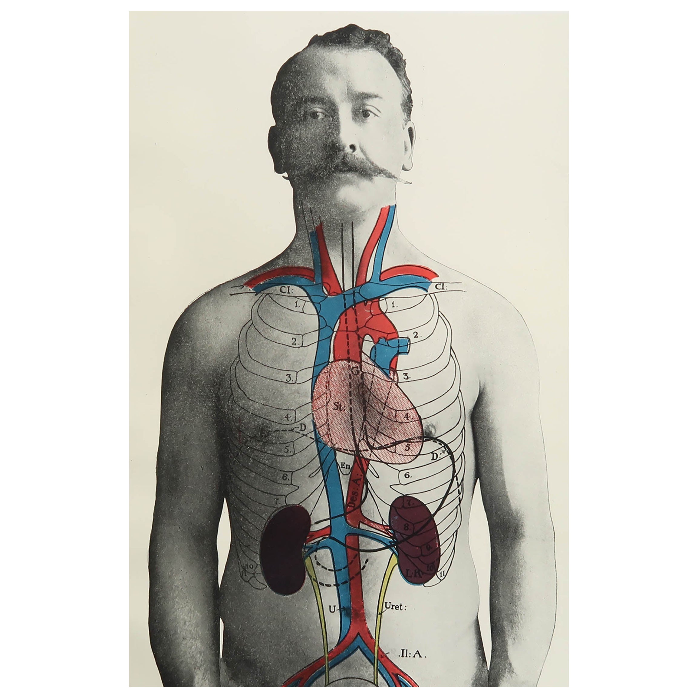 Original Vintage Medical Print, Kidneys, C.1900