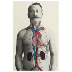 Original Vintage Medical Print, Kidneys, C.1900