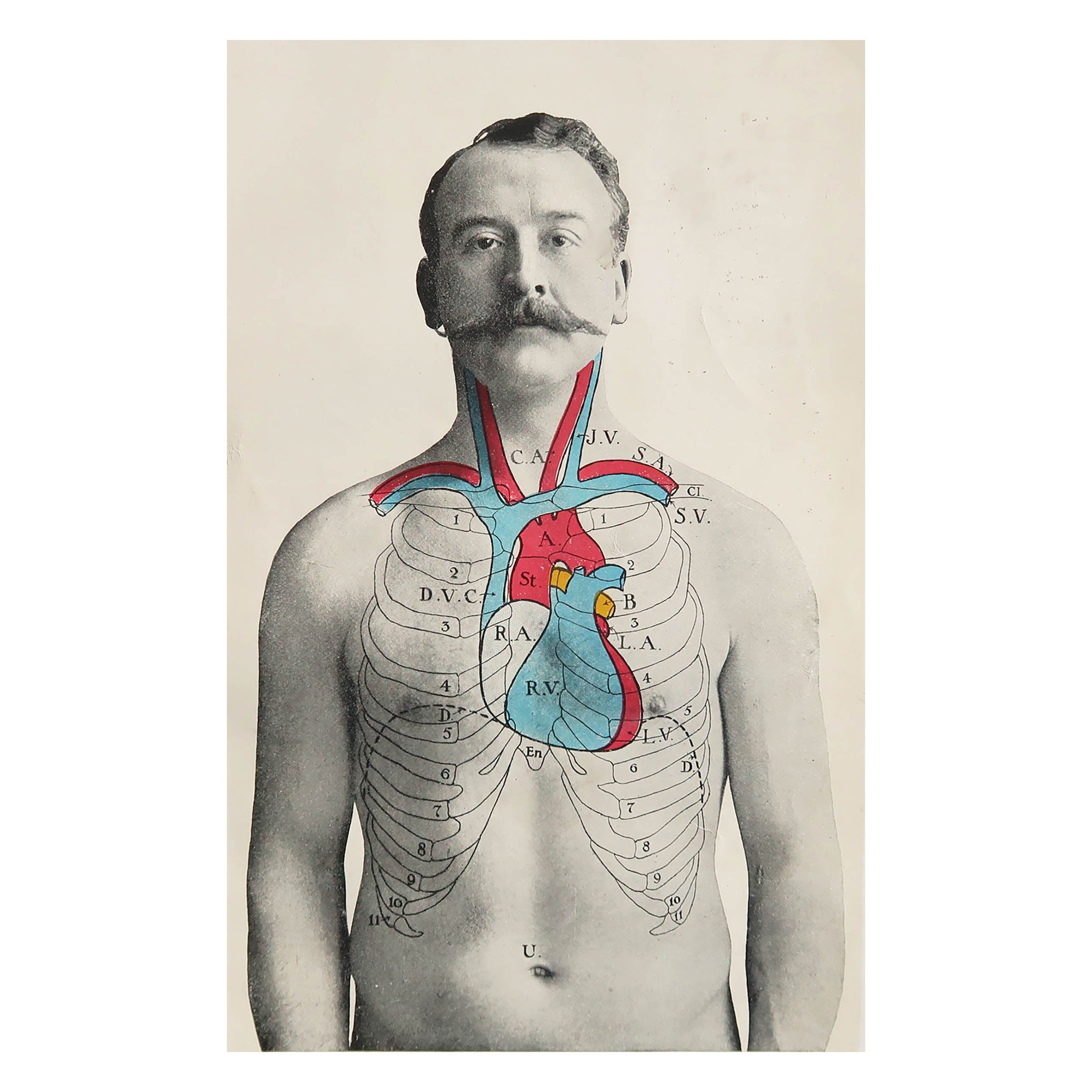 Original Vintage Medical Print, the Heart, circa 1900