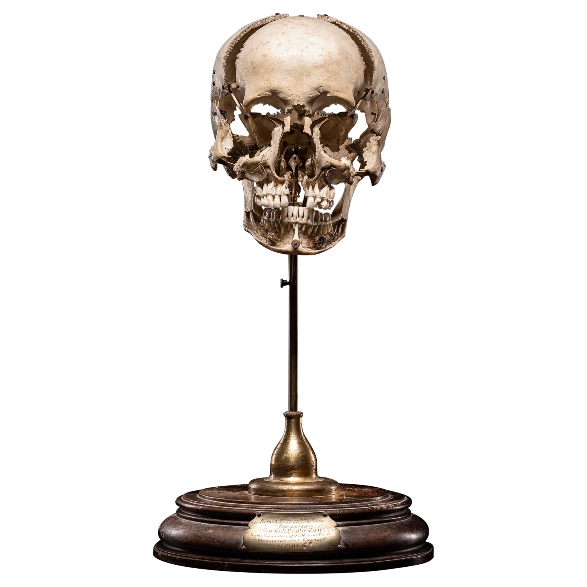 Crâne humain désarticulé d'Edmé Beauchêne avec provenance muséale, France