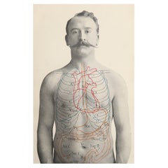 Impression médicale originale vintage, Stomach, datant d'environ 1900