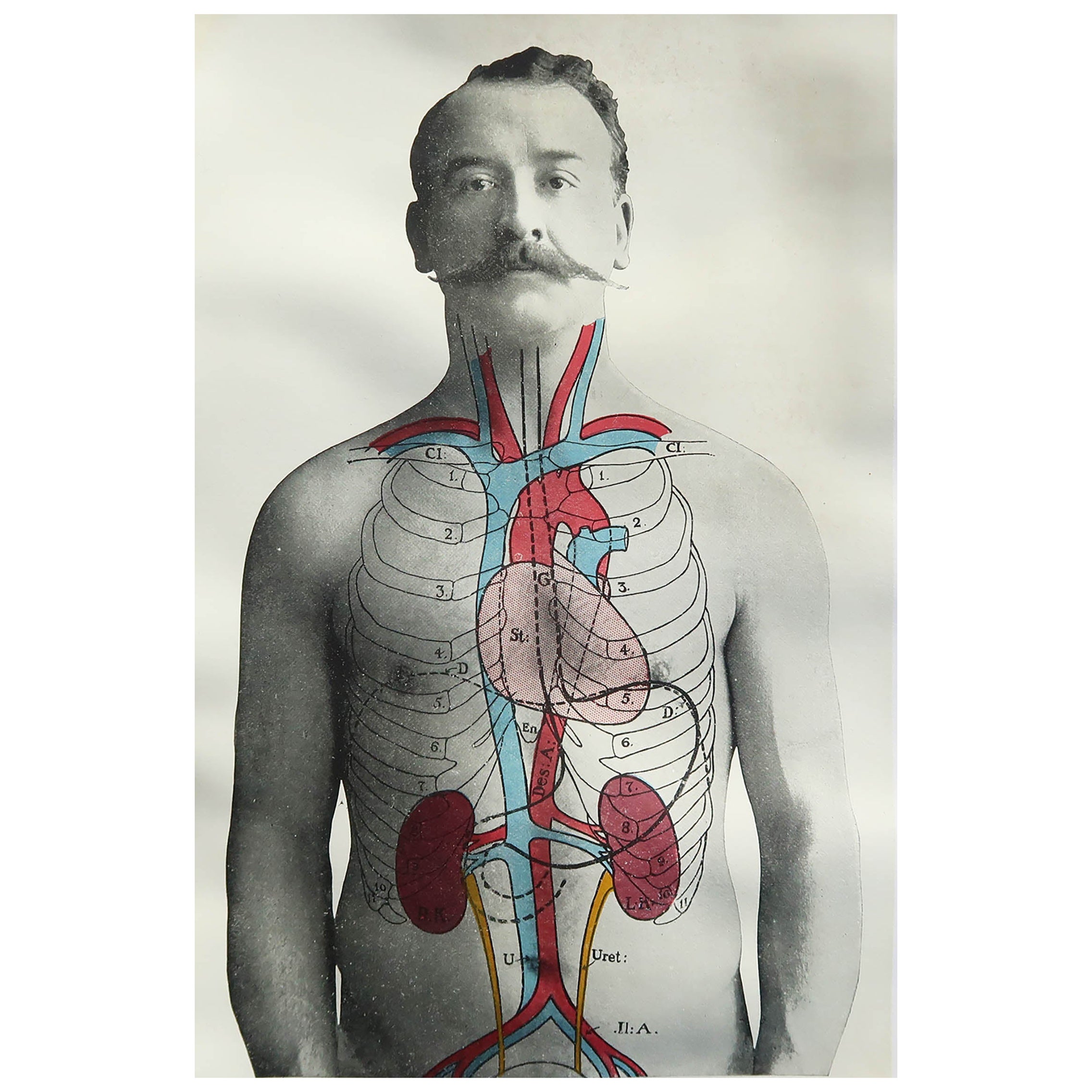 Original Vintage Medical Print, Kidneys, C.1900 For Sale