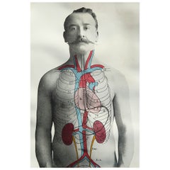 Original Antique Medical Print, Kidneys, C.1900