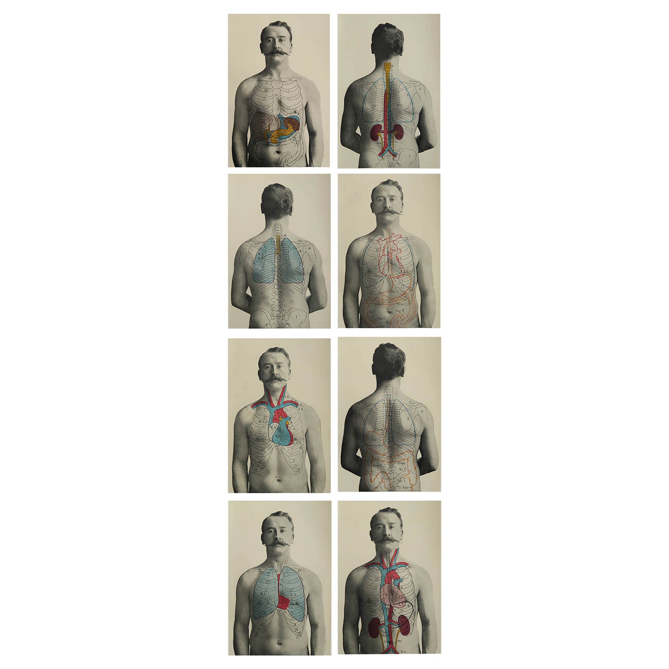 Ensemble de 8 estampes médicales originales vintage, vers 1900