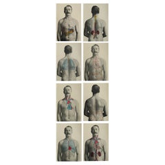 Set von 8 Original-Vintage-Medizindrucken, um 1900