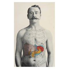Original Antique Medical Print, Liver, Spleen and Pancreas, circa 1900