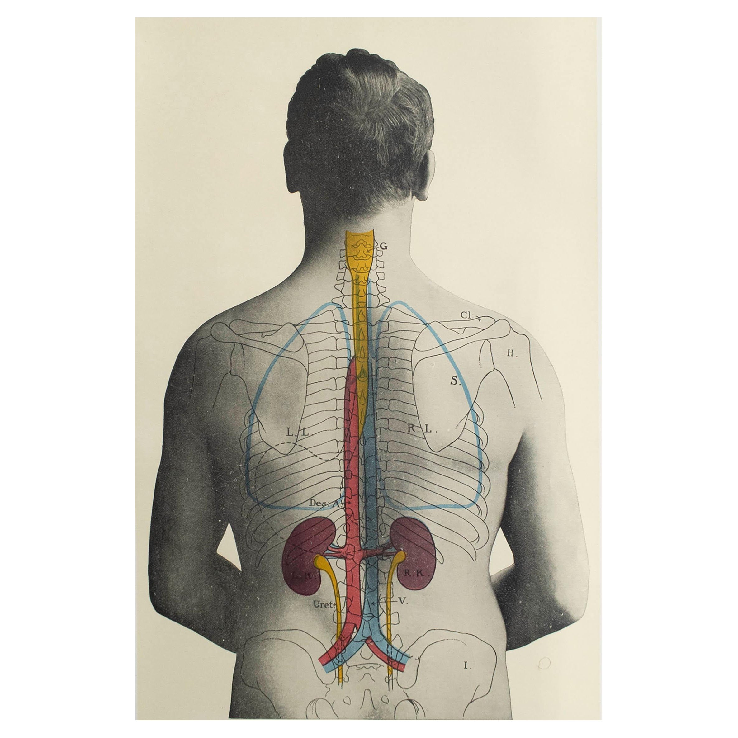 Original Vintage Medical Print- Kidneys, C.1900