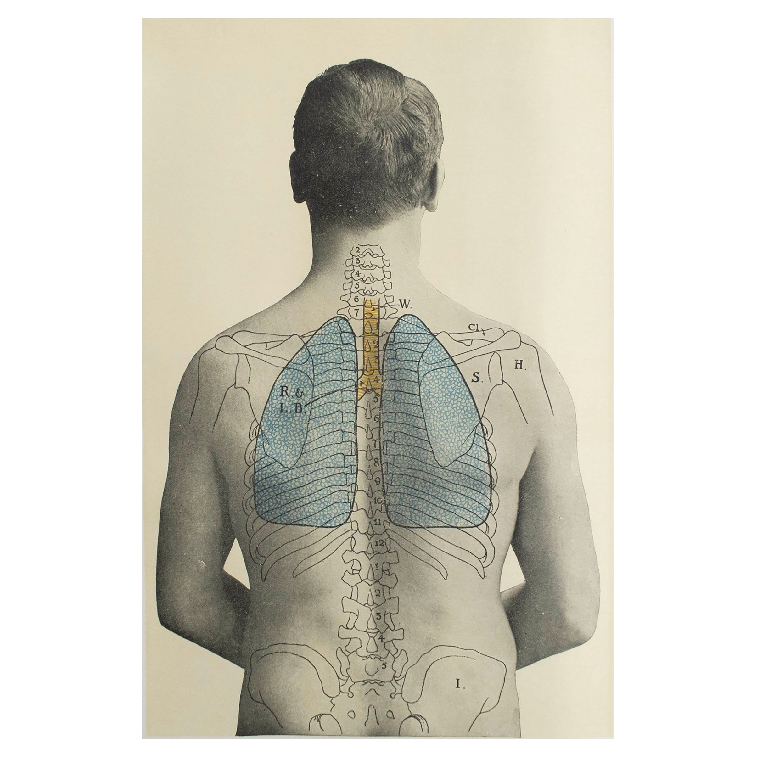 Impresión Médica Vintage Original, Pulmones, C.1900