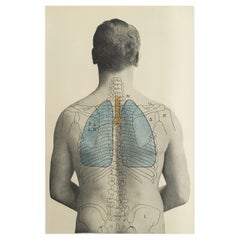 Original Antique Medical Print, Lungs, C.1900