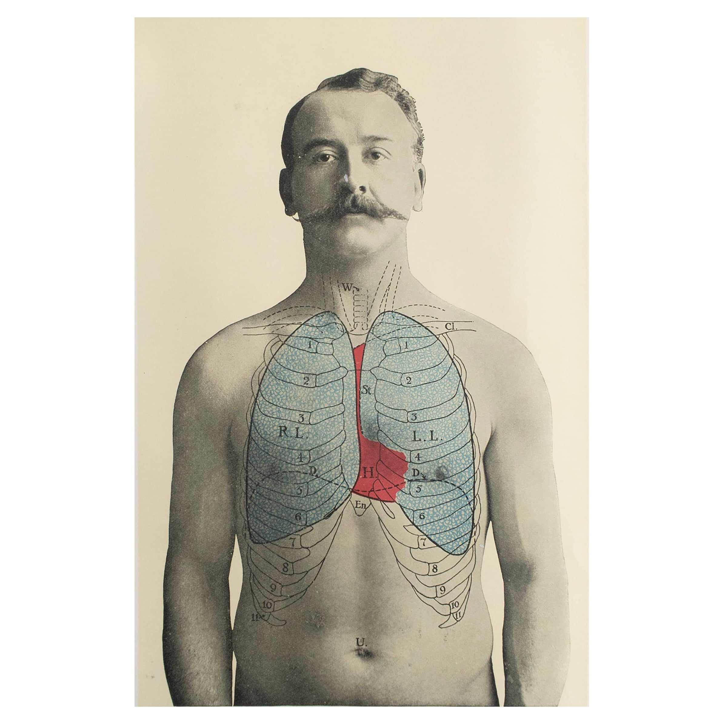 Original Vintage Medical Print, Lungs, C.1900