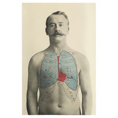 Impression médicale originale vintage, Lungs, C.1900
