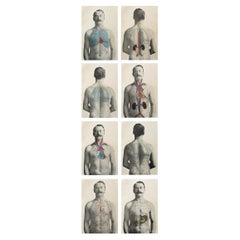 Conjunto de 8 Impresiones Médicas Vintage Originales, circa 1900
