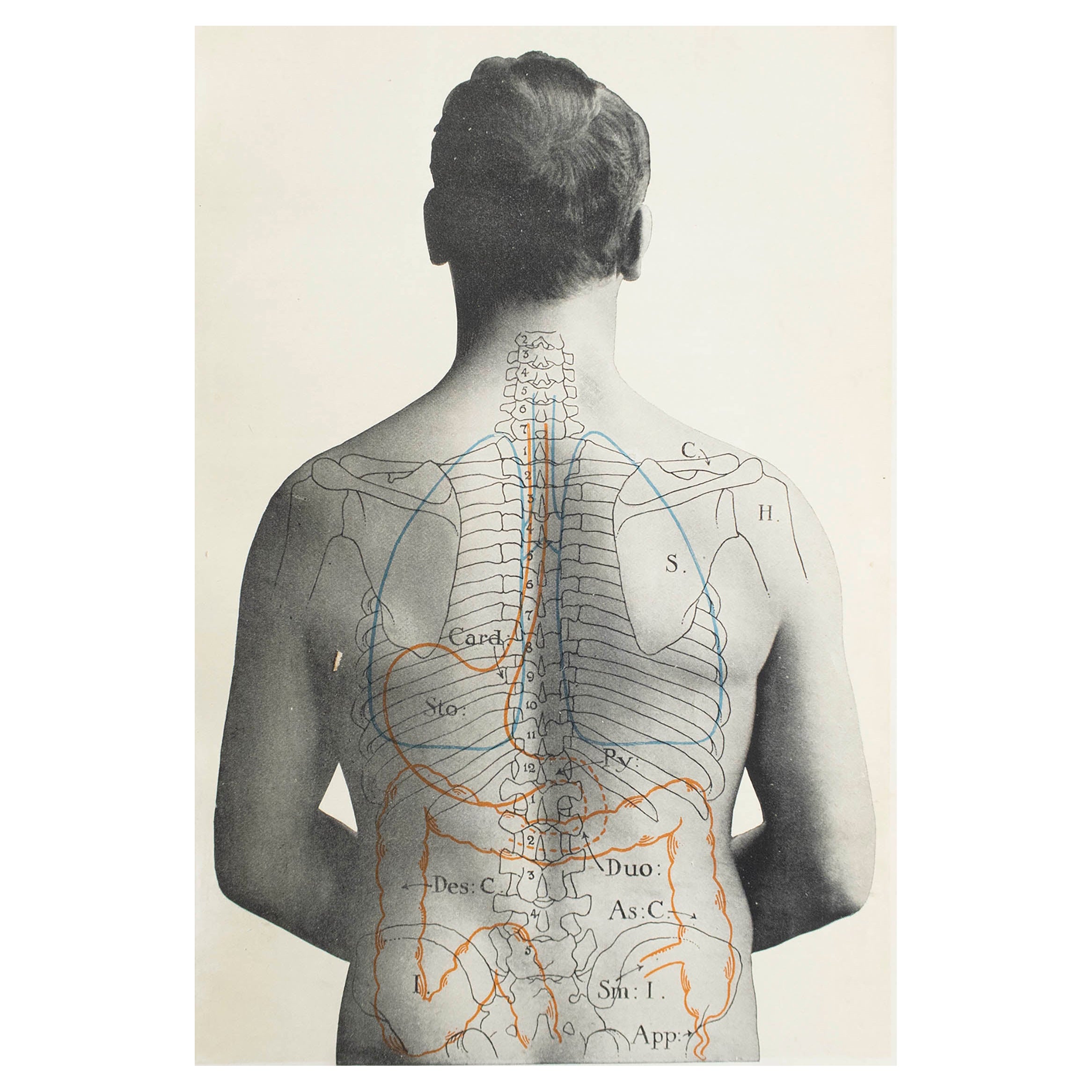 Originaler medizinischer Druck im Vintage-Stil, Stomach, um 1900 im Angebot