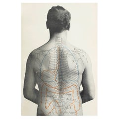 Impression médicale originale vintage Stomach, vers 1900