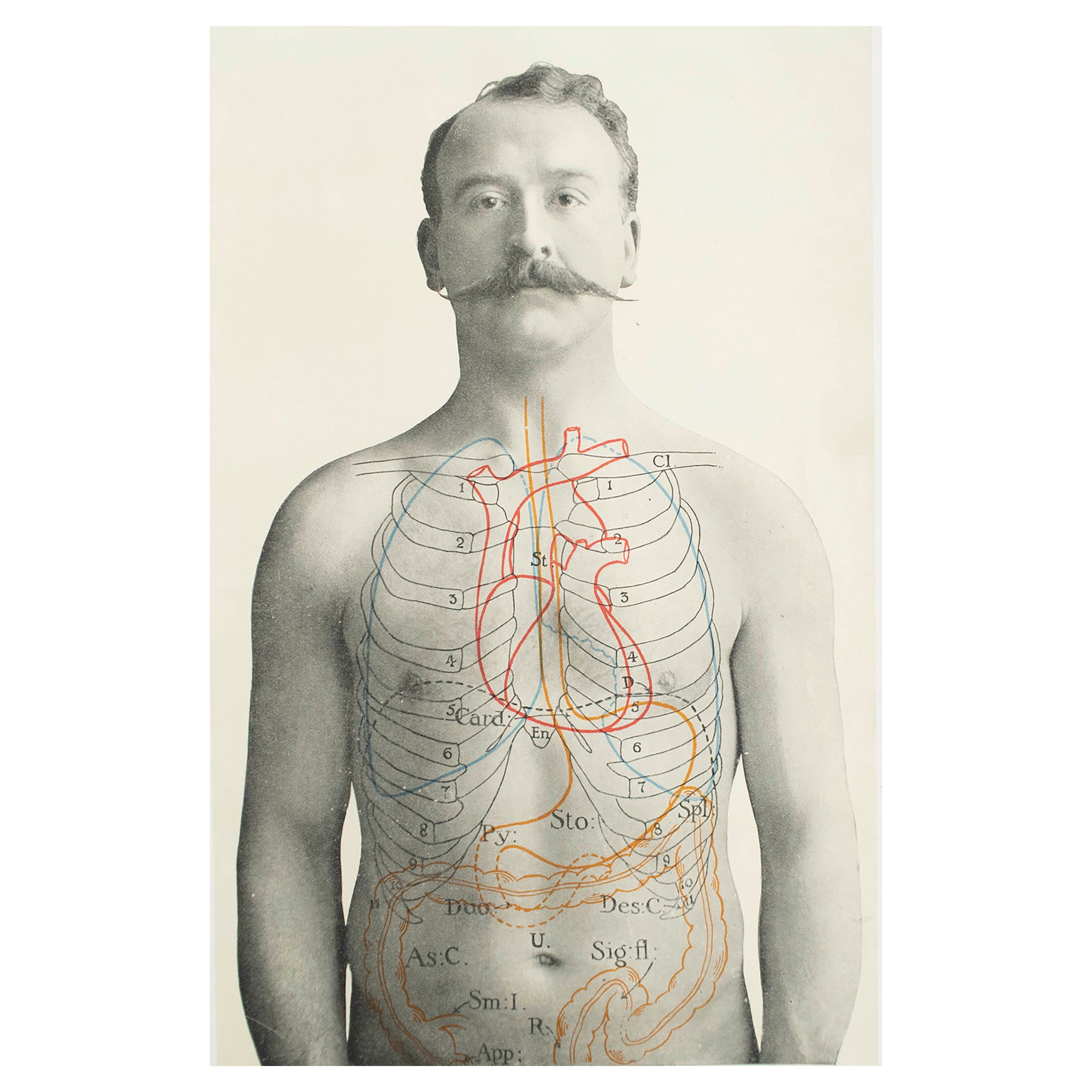 Original Vintage Medical Print, Stomach, circa 1900 For Sale
