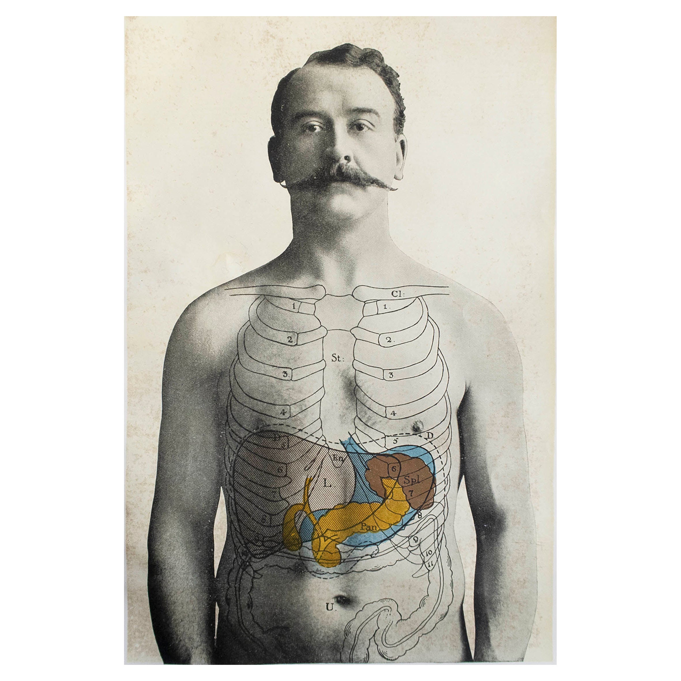 Original Vintage Medical Print, Liver, Spleen and Pancreas, circa 1900 For Sale