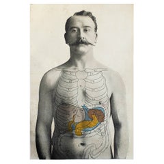 Impression médicale originale vintage, « Liver, Spleen and Pancreas » (vivre, yeux et lèvre), vers 1900