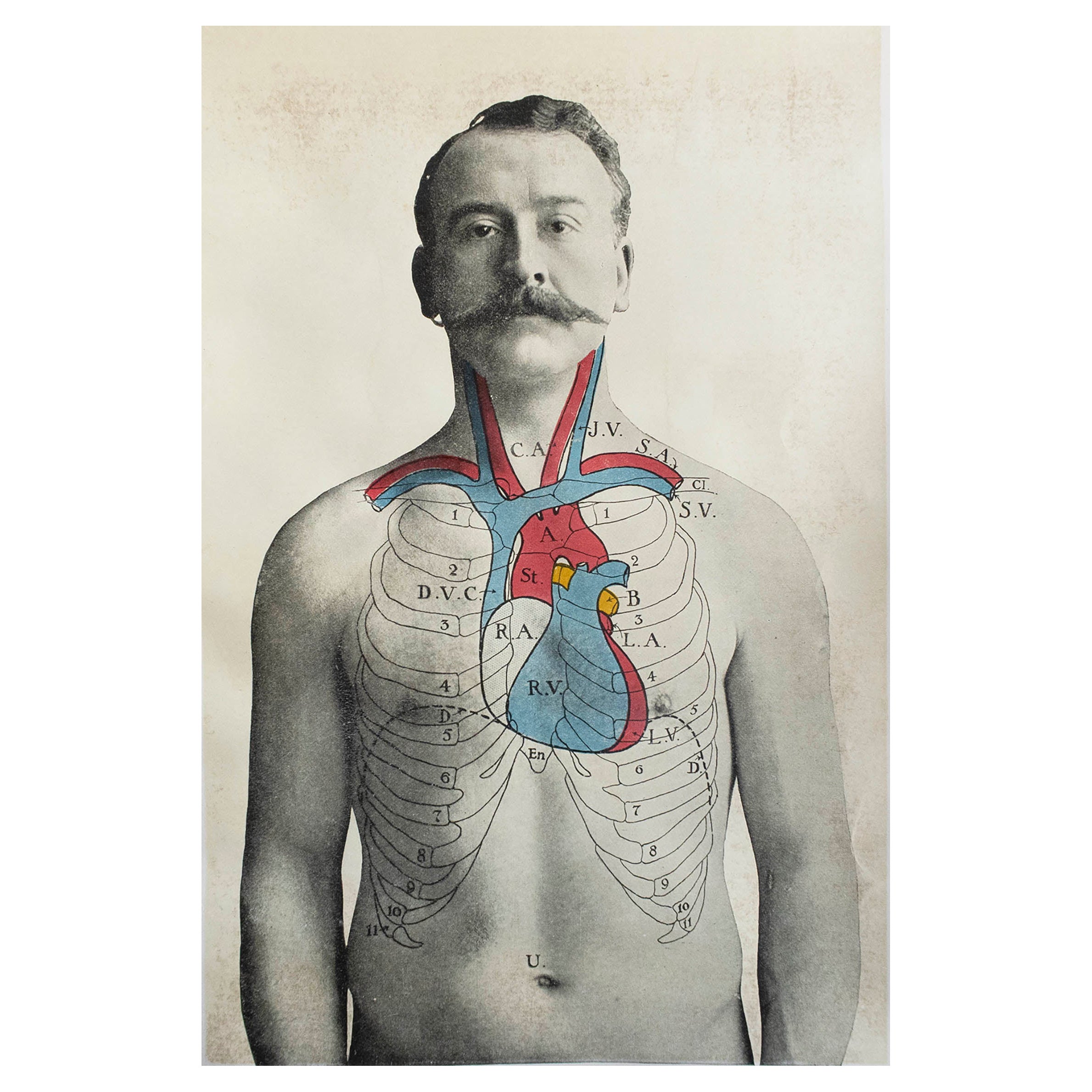 Impression médicale originale, le cœur, vers 1900