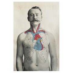 Impression médicale originale, le cœur, vers 1900