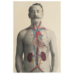 Original Antique Medical Print, Kidneys, C.1900