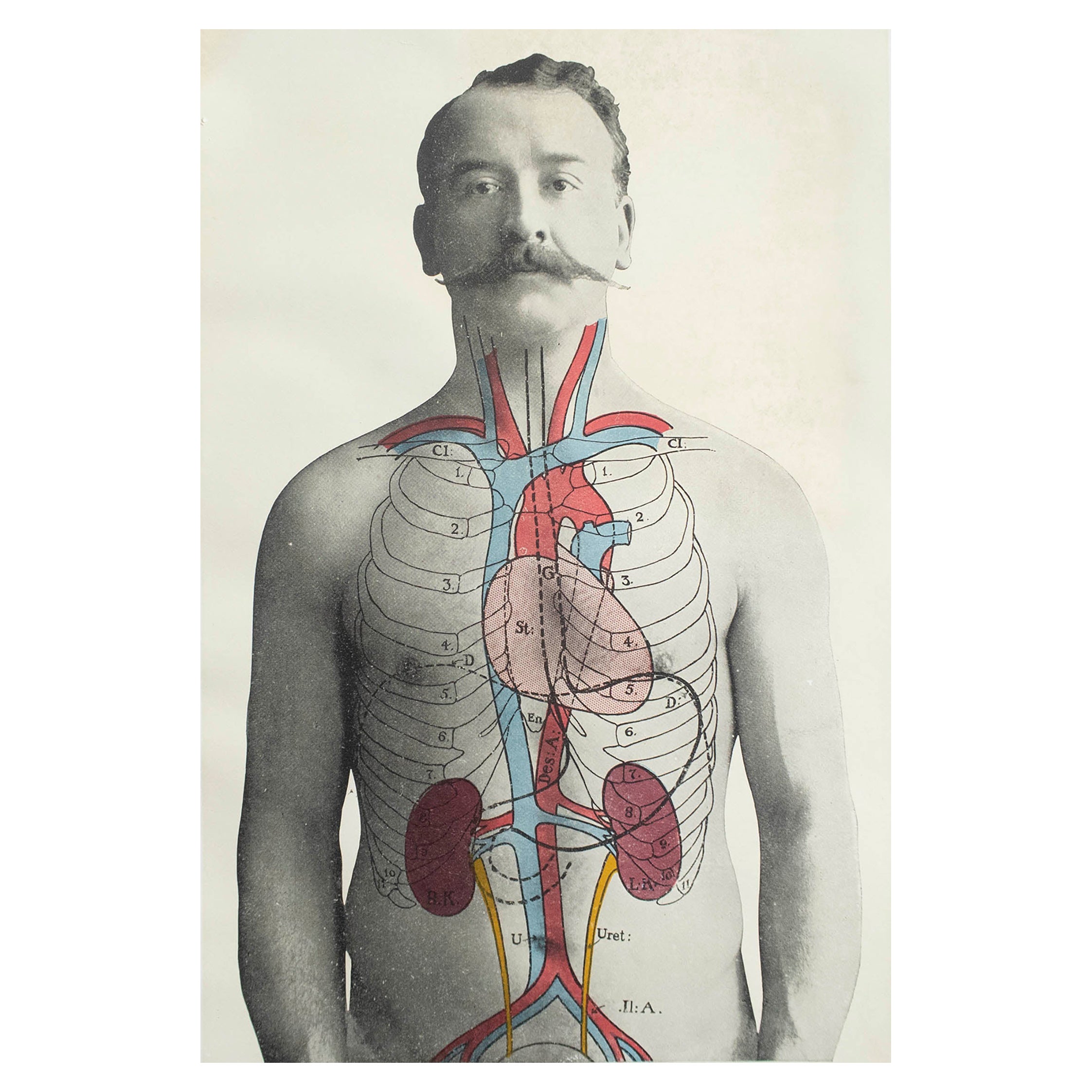 Original Vintage Medical Print, Kidneys, C.1900 For Sale