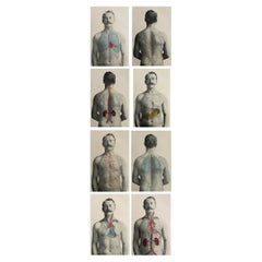 Ensemble de 8 estampes médicales originales vintage, vers 1900