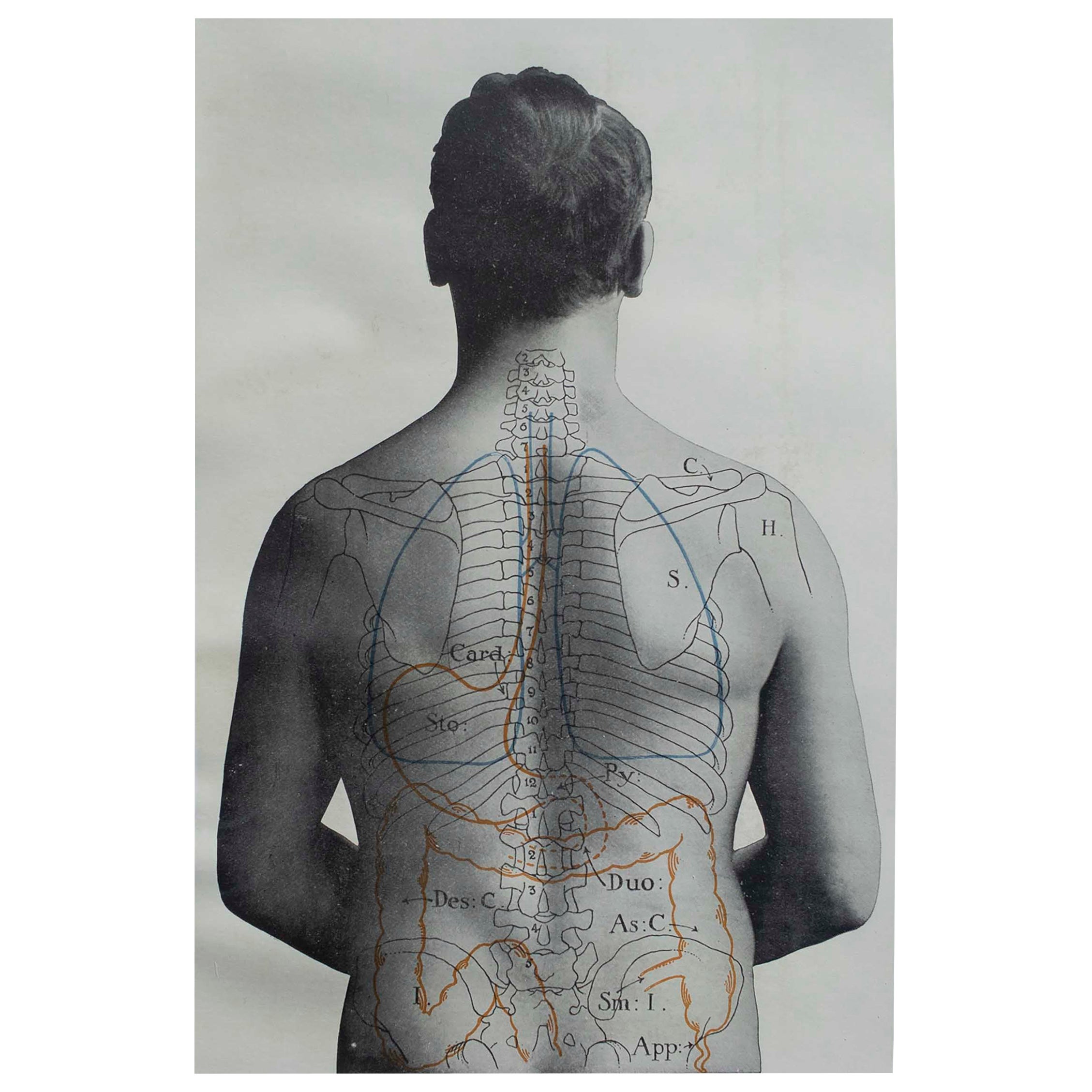 Original Vintage Medical Print- Stomach, circa 1900