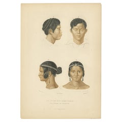 Handcolored 1849 Engraving of Siamese Brother & Woman from Calcutta, d'Orbigny
