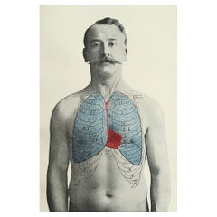 Originaler medizinischer Druck im Vintage-Stil, Lungs, um 1900