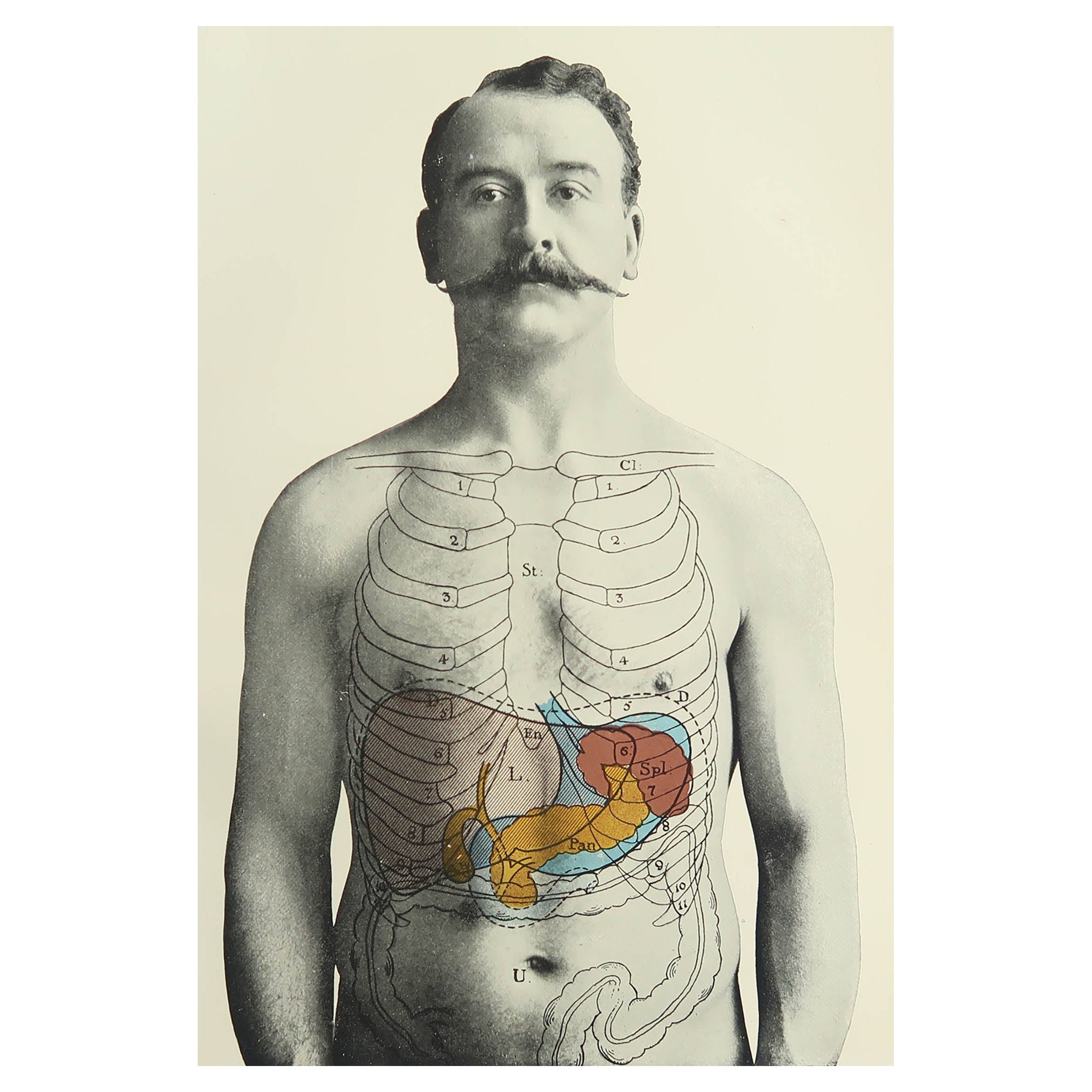 Originaler medizinischer Vintage-Druck, Liver, Spleen und Pancreas, um 1900