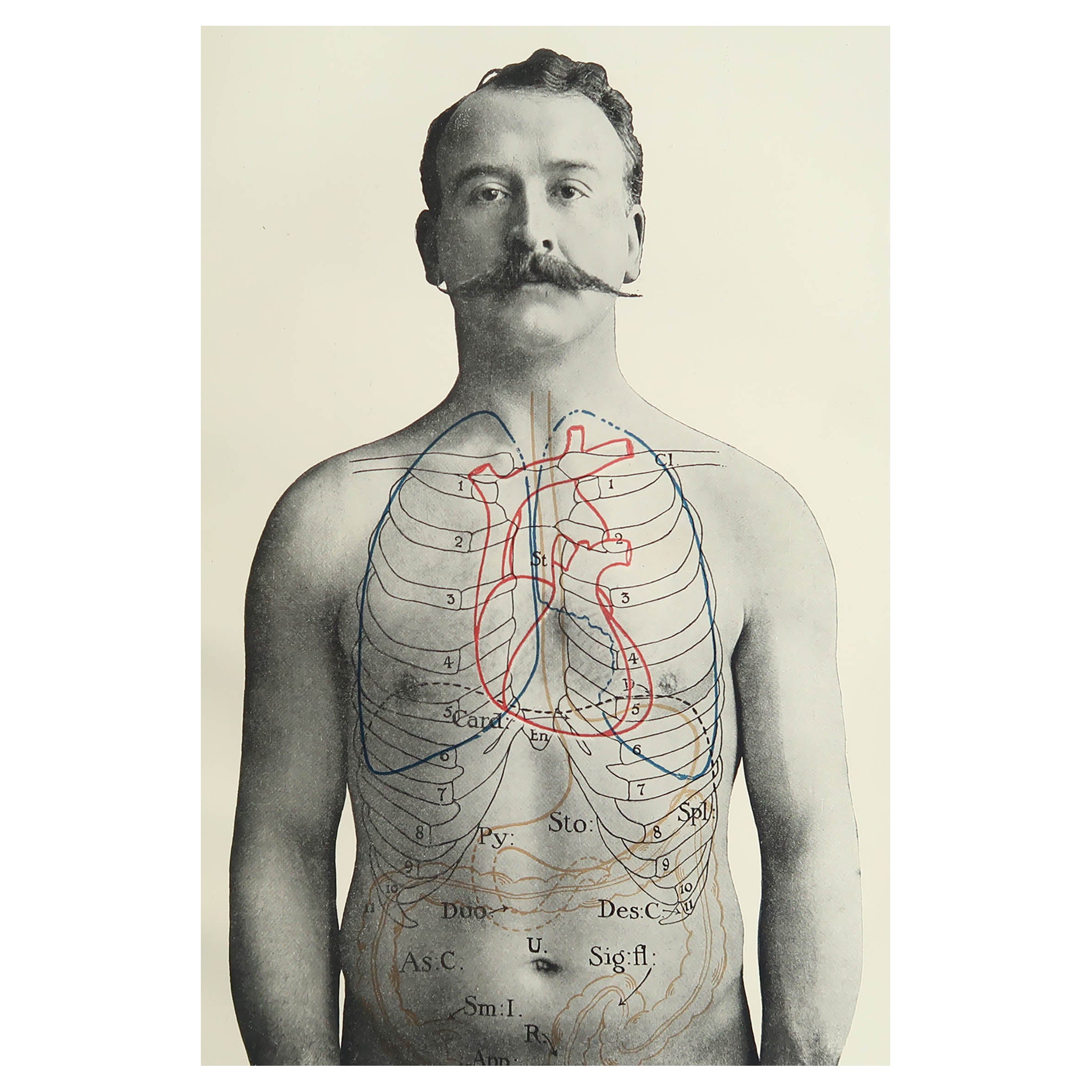Original Vintage Medical Print, Stomach, circa 1900