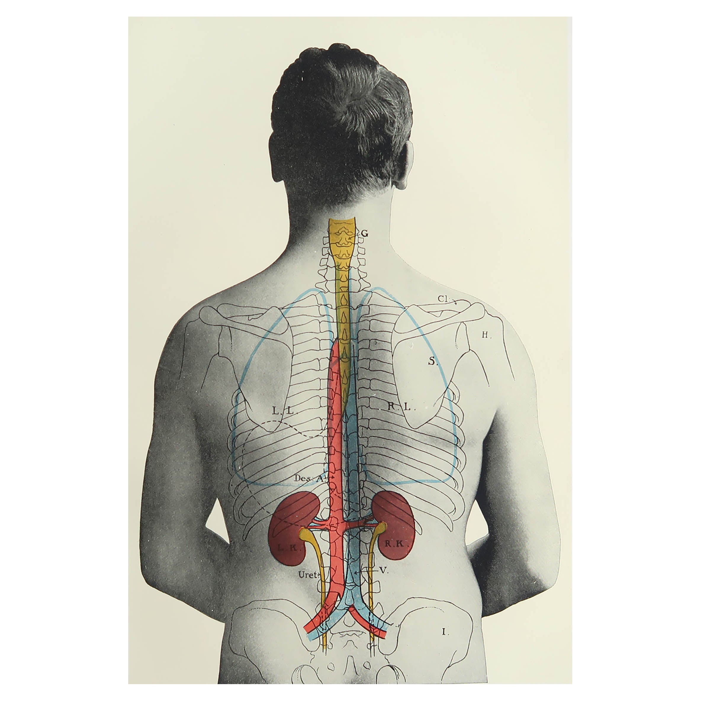 Original Vintage Medical Print- Kidneys, C.1900